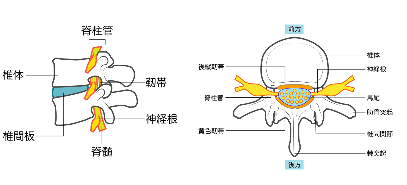 背骨の嚢胞の原因は何ですか？ | 坐骨神経痛 腰椎に嚢胞 _ 正中頸嚢胞とは？原因と治療法を詳しく解説 – DPXP