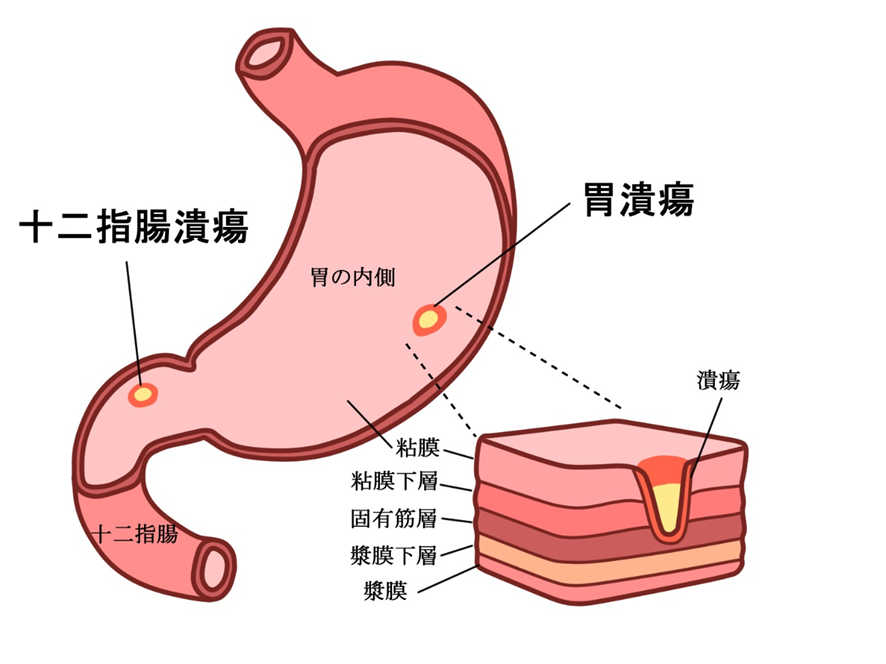 胃　解剖