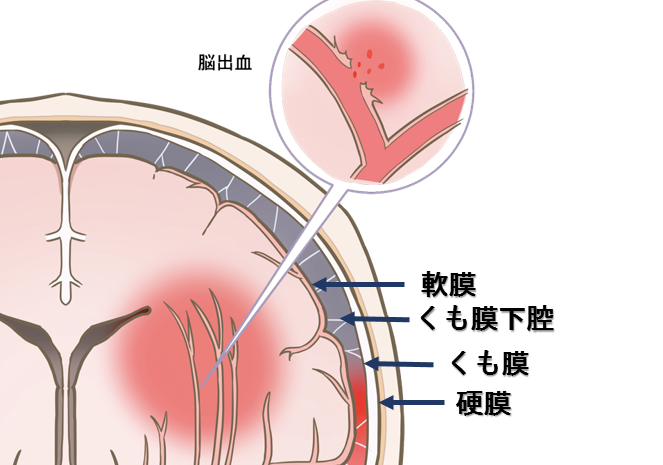 髄膜の解剖