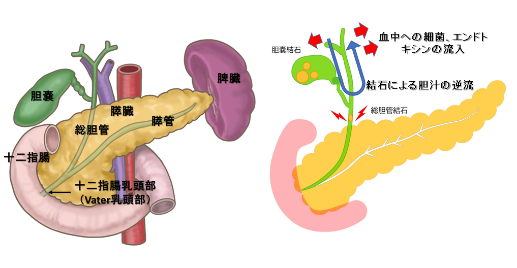 胆管膵　解剖と急胆管炎の原因